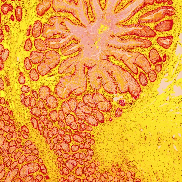 Innerbloom