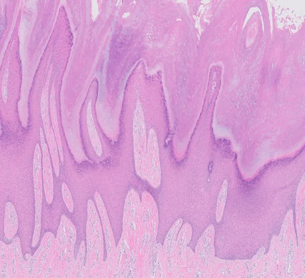 Original histology slide for Stalactites