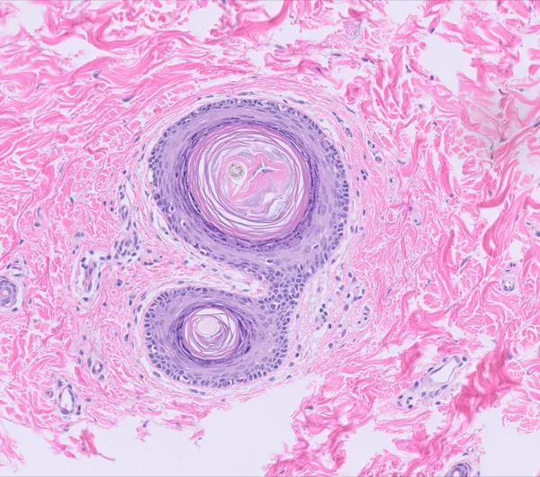 Original histology slide for The Germinal Seed