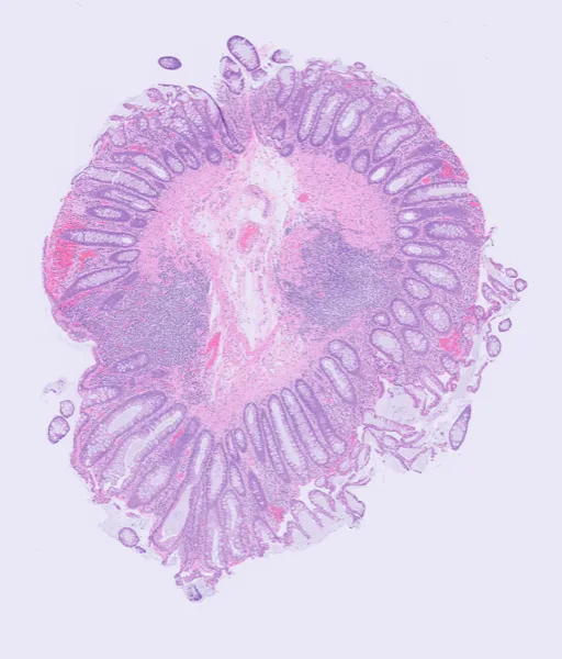 Original histology slide for The Goldon Lion