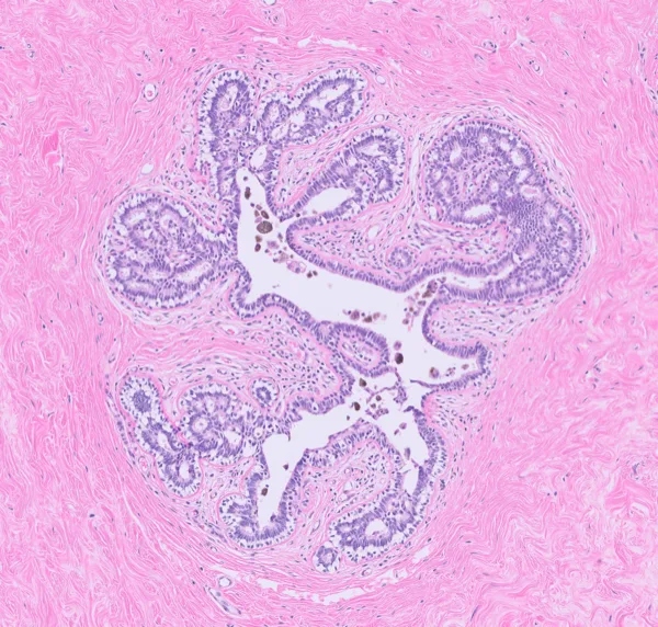 Original histology slide for Dancing Bird