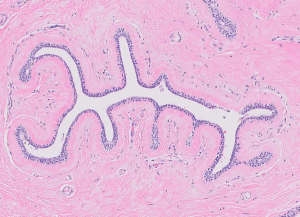 Original histology slide for Scorpio Tail