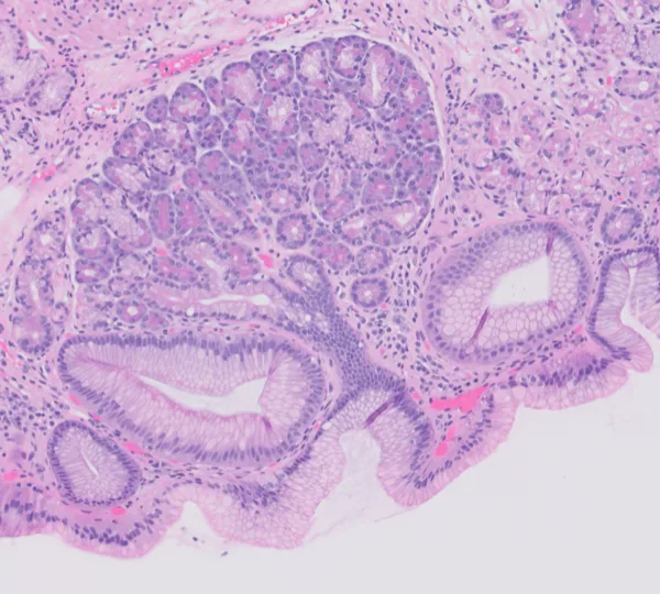 Original histology slide for Jester