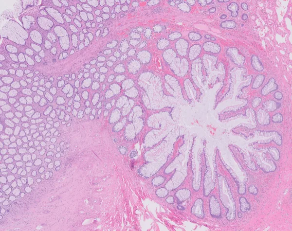Original histology slide for Innerbloom