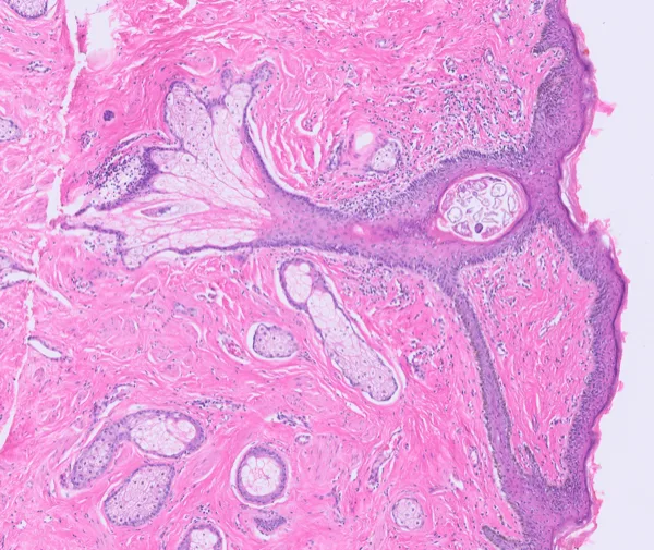 Original histology slide for Amarylis