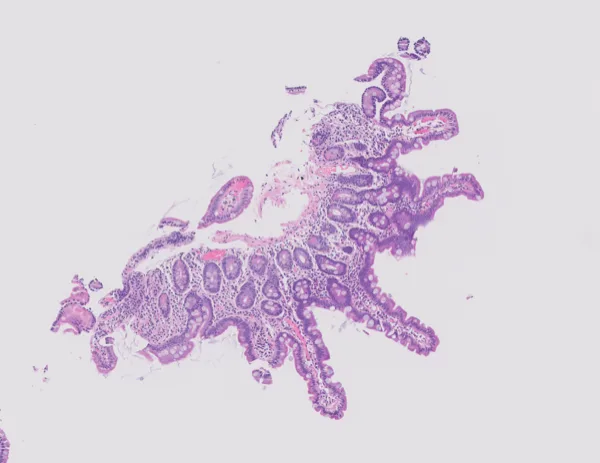 Original histology slide for Seahorse