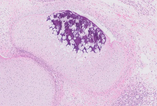 Original histology slide for Beehive