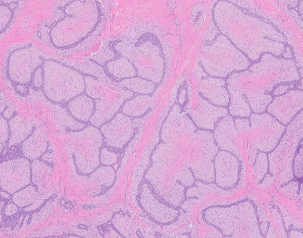Original histology slide for Purple Moss
