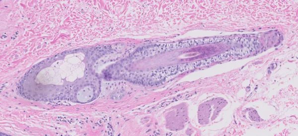 Original histology slide for The Blue of Hair