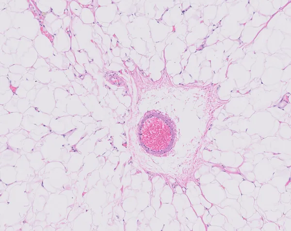 Original histology slide for Space Eye
