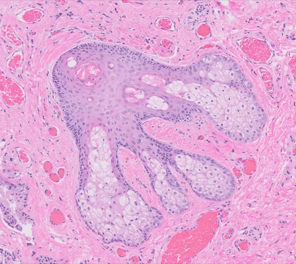 Original histology slide for Soft-bodied