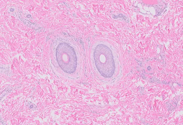 Original histology slide for Between Blinks