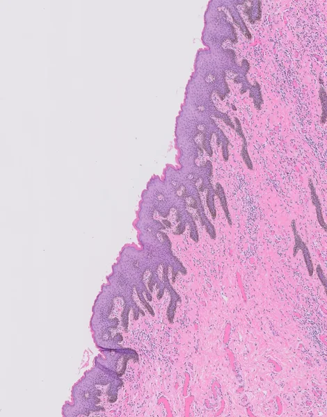 Original histology slide for Frozen Sea Weed