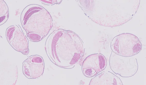Original histology slide for Olives