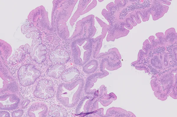 Original histology slide for Lush