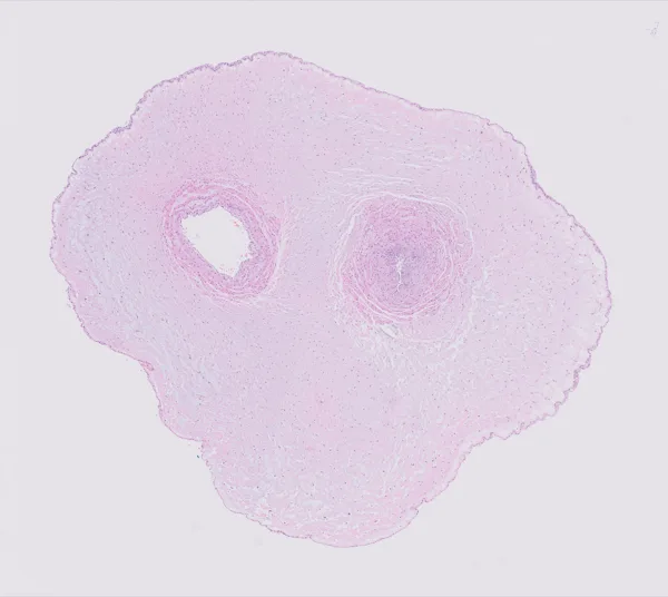 Original histology slide for Mask