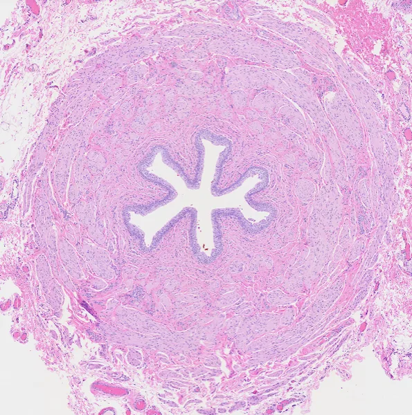 Original histology slide for The Man In Blue