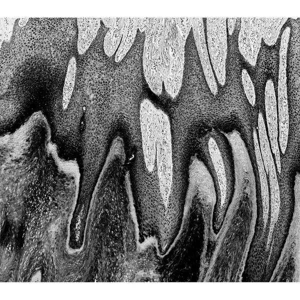 Stalactites