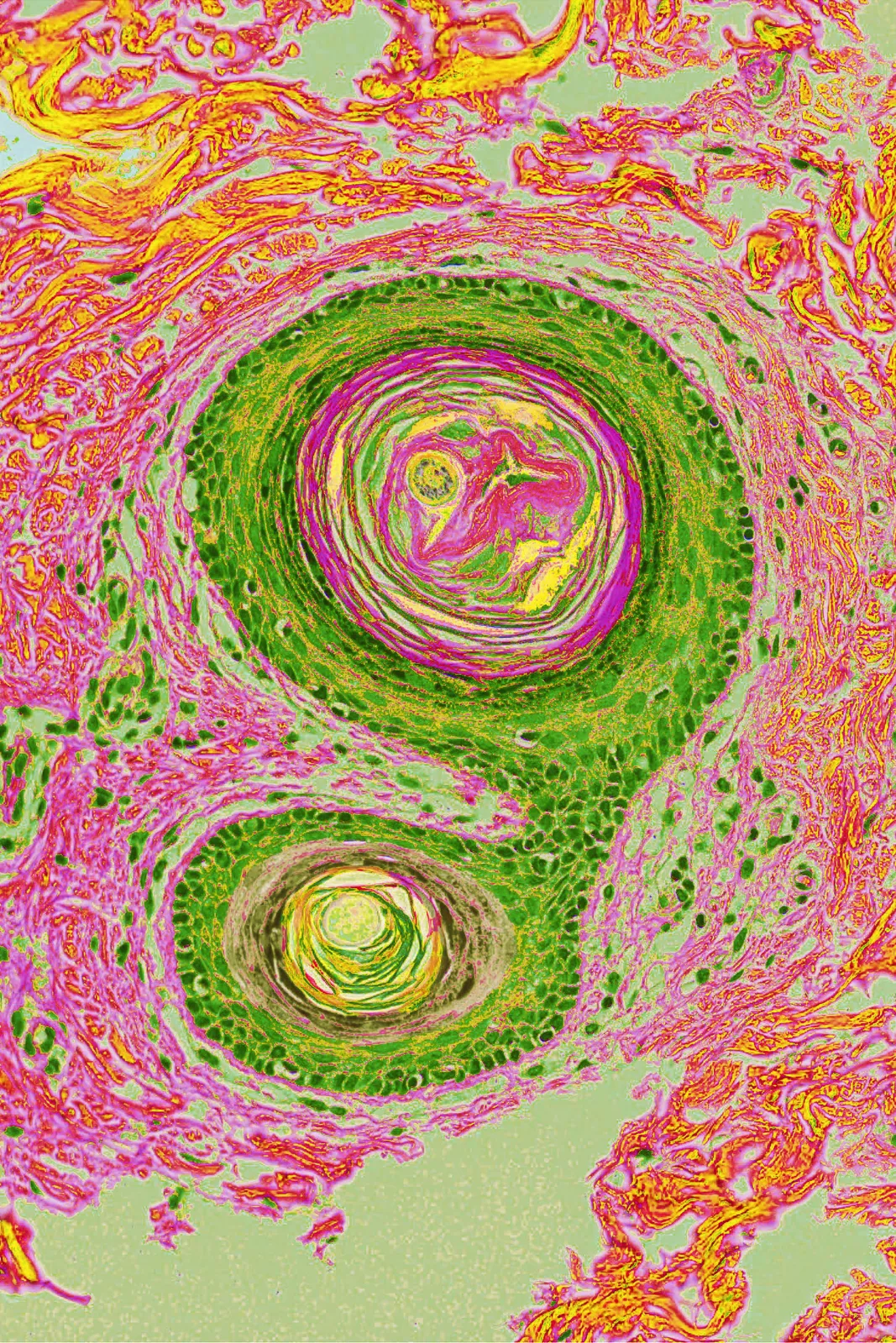 The Germinal Seed