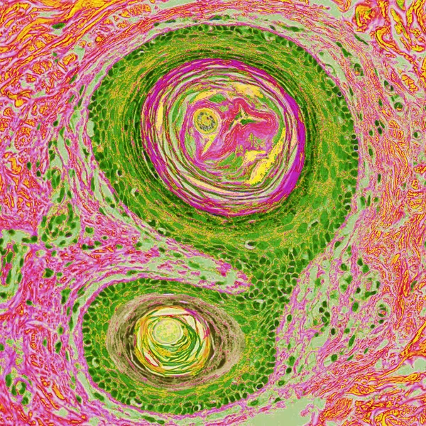 The Germinal Seed